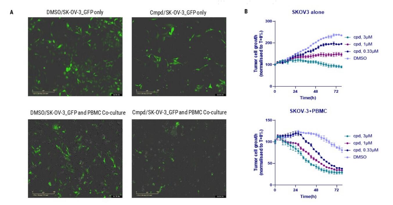 Incucyte 评估 METTL3 抑制剂增强 PBMC 介导的肿瘤细胞杀伤